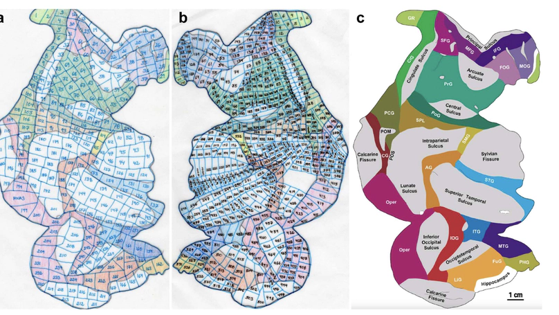 Integrated metabolomics and proteomics from voxelated cortical hemispheres of adult rhesus monkeys